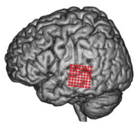 Recording sites in the posterior superior temporal gyrus (From Pasley et al., 2012)